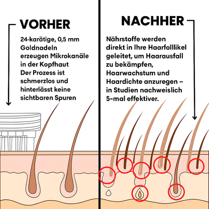 SenviaInfuse™ Haarauswachssystem